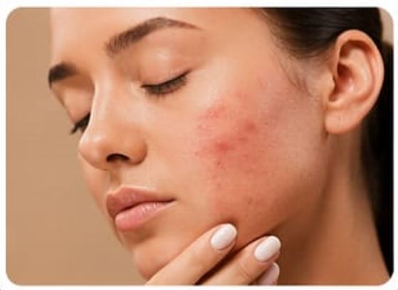 Skin Problems